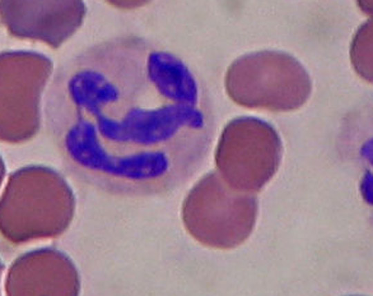 Real blood-smear micrograph showing a neutrophil; the source file is an existing crop.