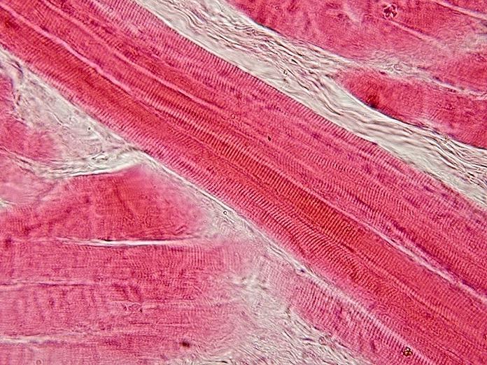 Longitudinal section of skeletal muscle, photographed through a microscope.