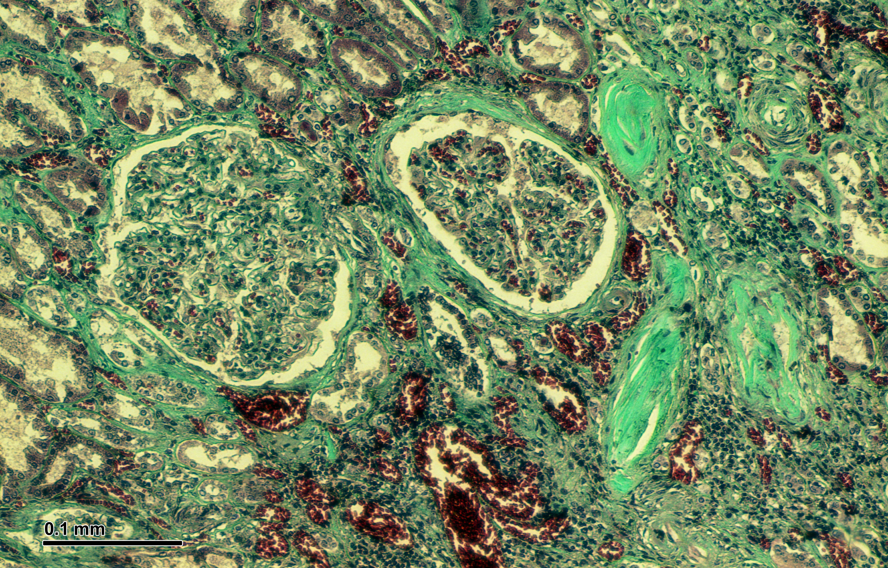 Real bright-field micrograph of human kidney tissue; display scaling does not preserve a fixed optical magnification.