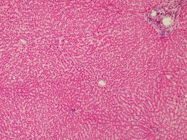 Real histological photograph of human liver tissue.