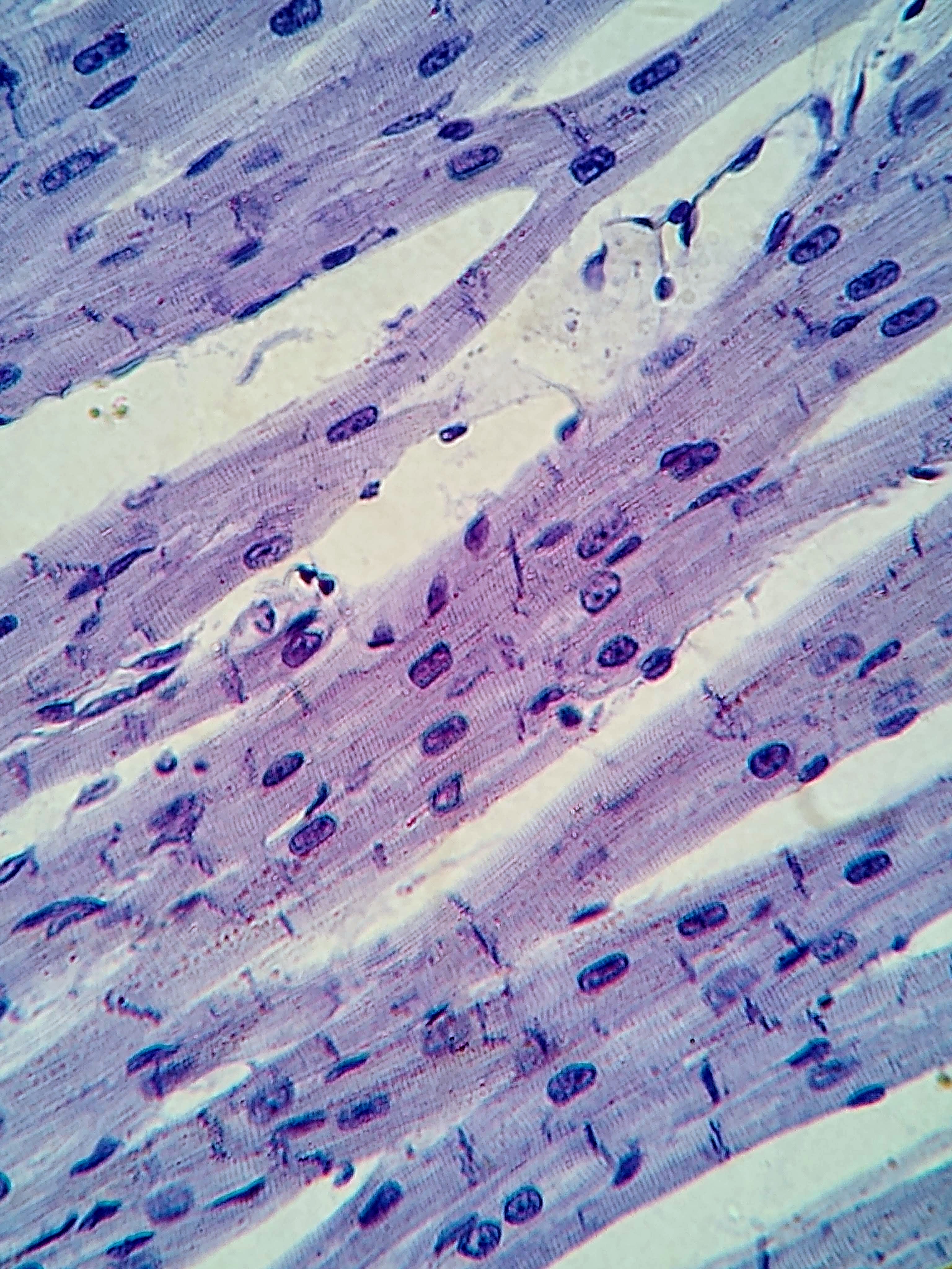 Light-microscope photograph of cardiac muscle; source magnification 400×.