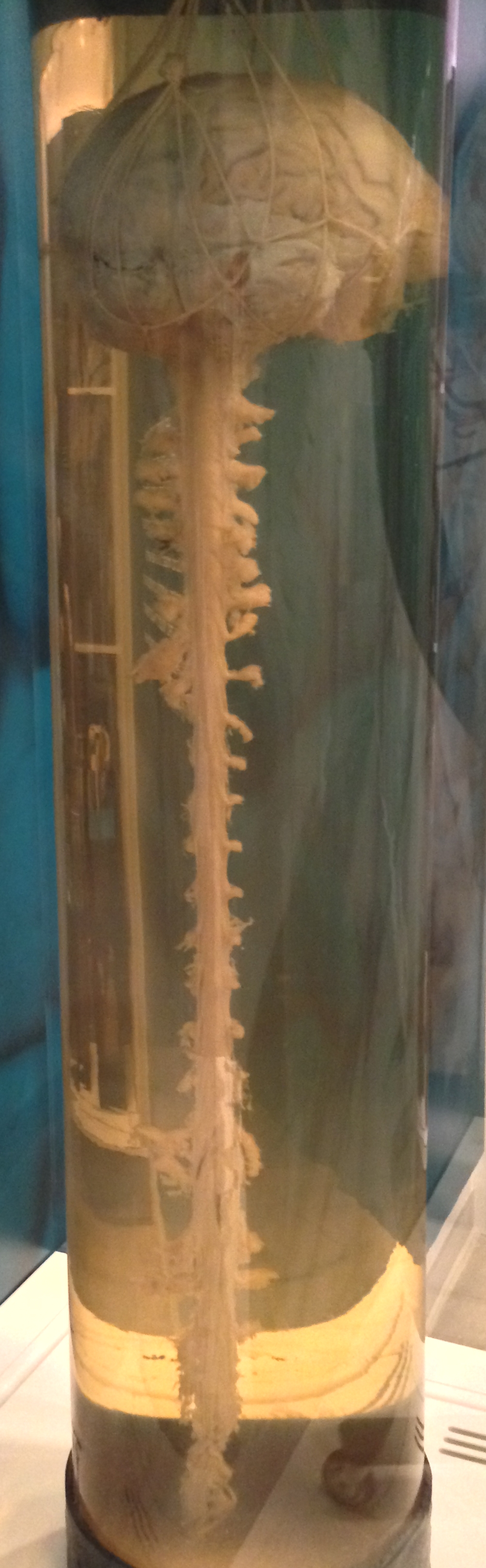 Real preserved human brain and spinal cord specimen in the National Museum of Health and Medicine. Preservation and display affect its appearance.