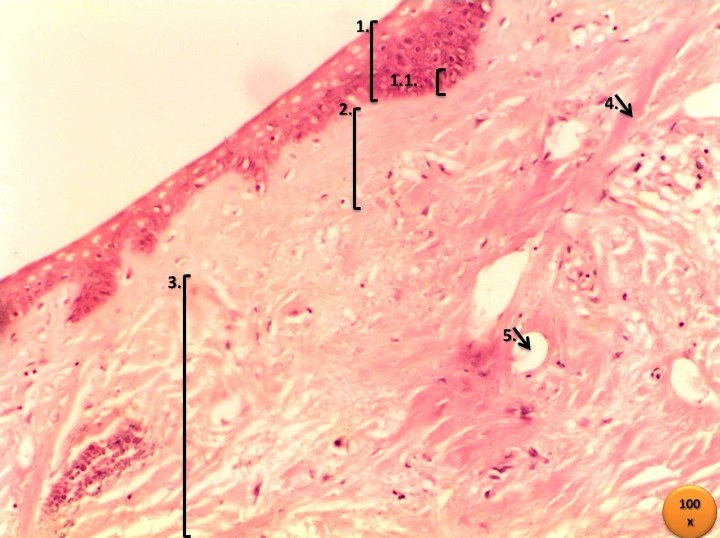 Real human skin micrograph stained with hematoxylin and eosin; source magnification 100×, display size varies. Original annotations are in Portuguese.