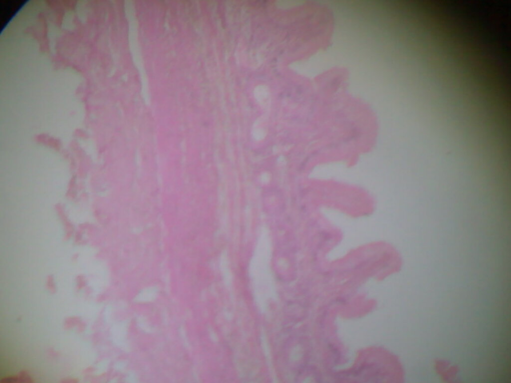 Real low-power microscopic photograph of gallbladder tissue. The source record does not explicitly state species or staining method.