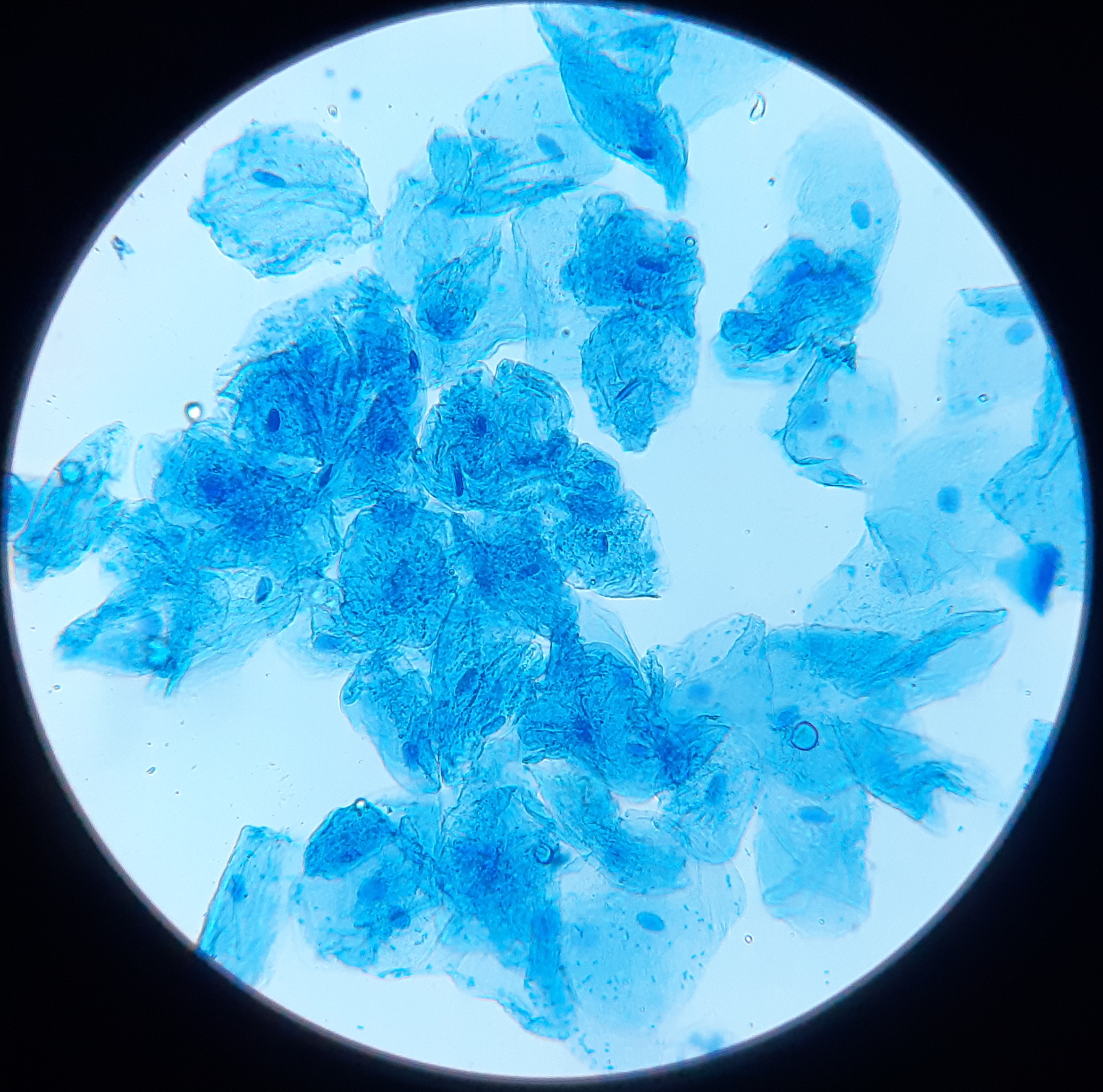 Real light-microscope photograph of a human cheek cell; the source does not specify stain or scale.