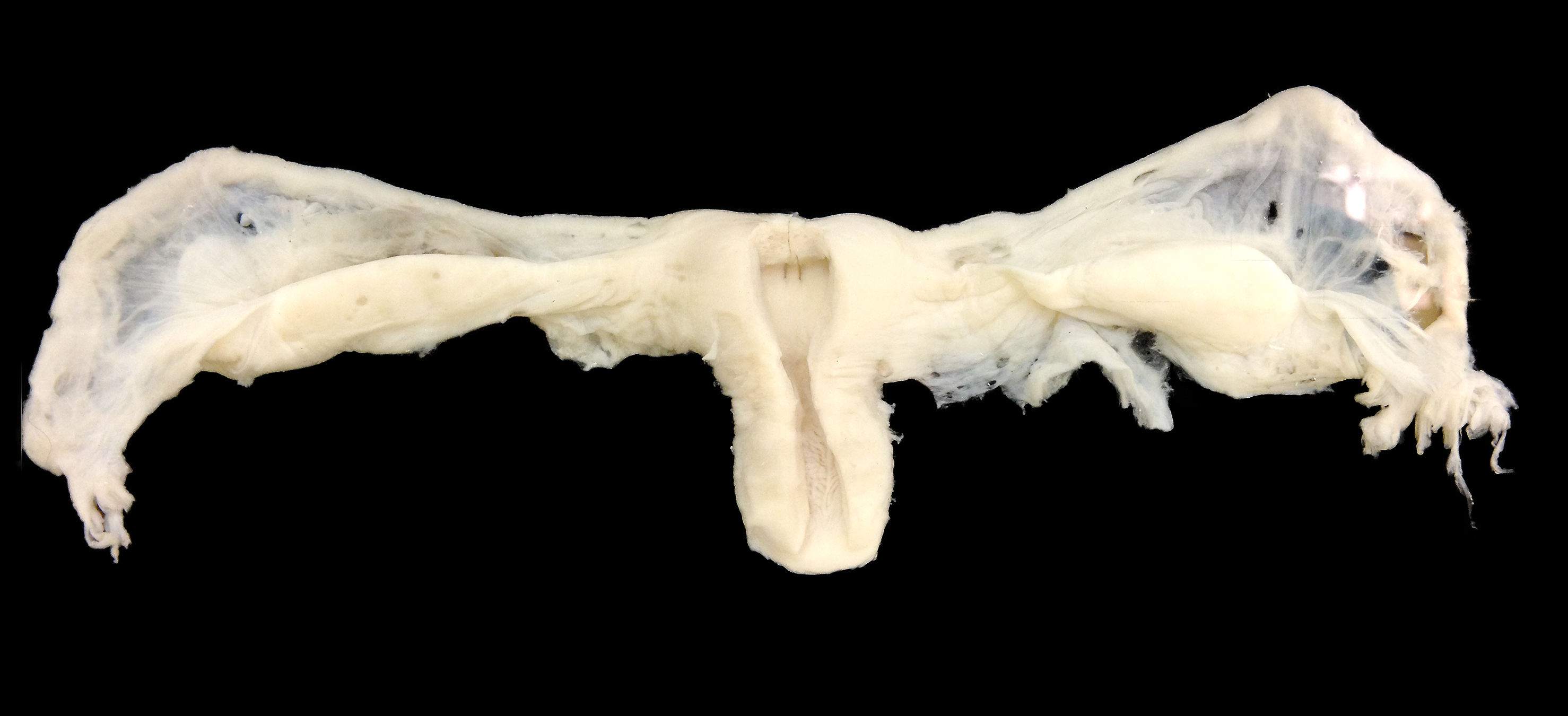 Photograph of a preserved reproductive-anatomy display including the ovarian and uterine region, Anatomical Museum, Basel.