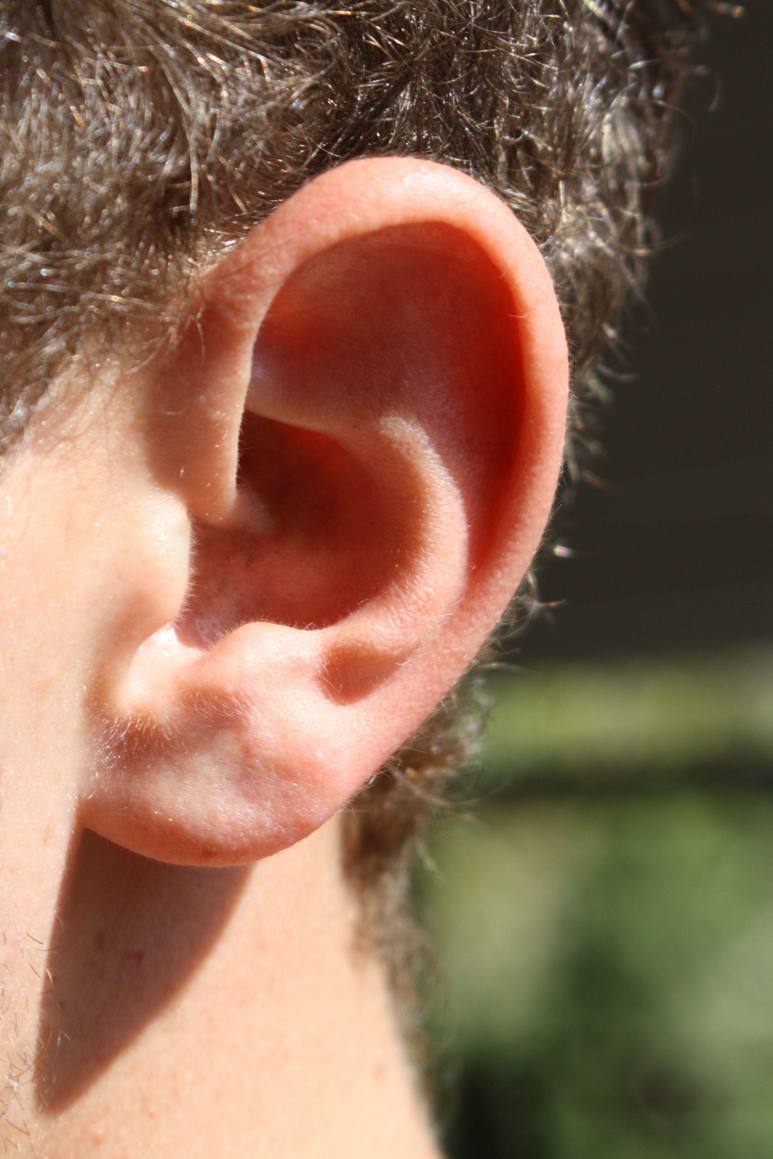 Real close-up photograph of an external human ear; internal hearing and vestibular structures are not visible.