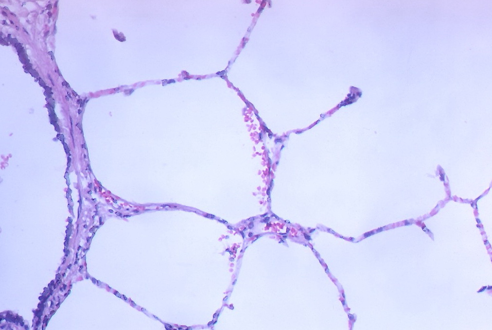 Real lung micrograph showing alveoli around a terminal bronchiole; the source does not explicitly state species.