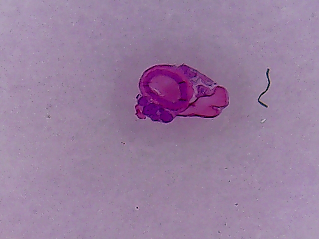 Real microscopic cross section of an artery and a vein. The source does not specify species, stain or magnification.