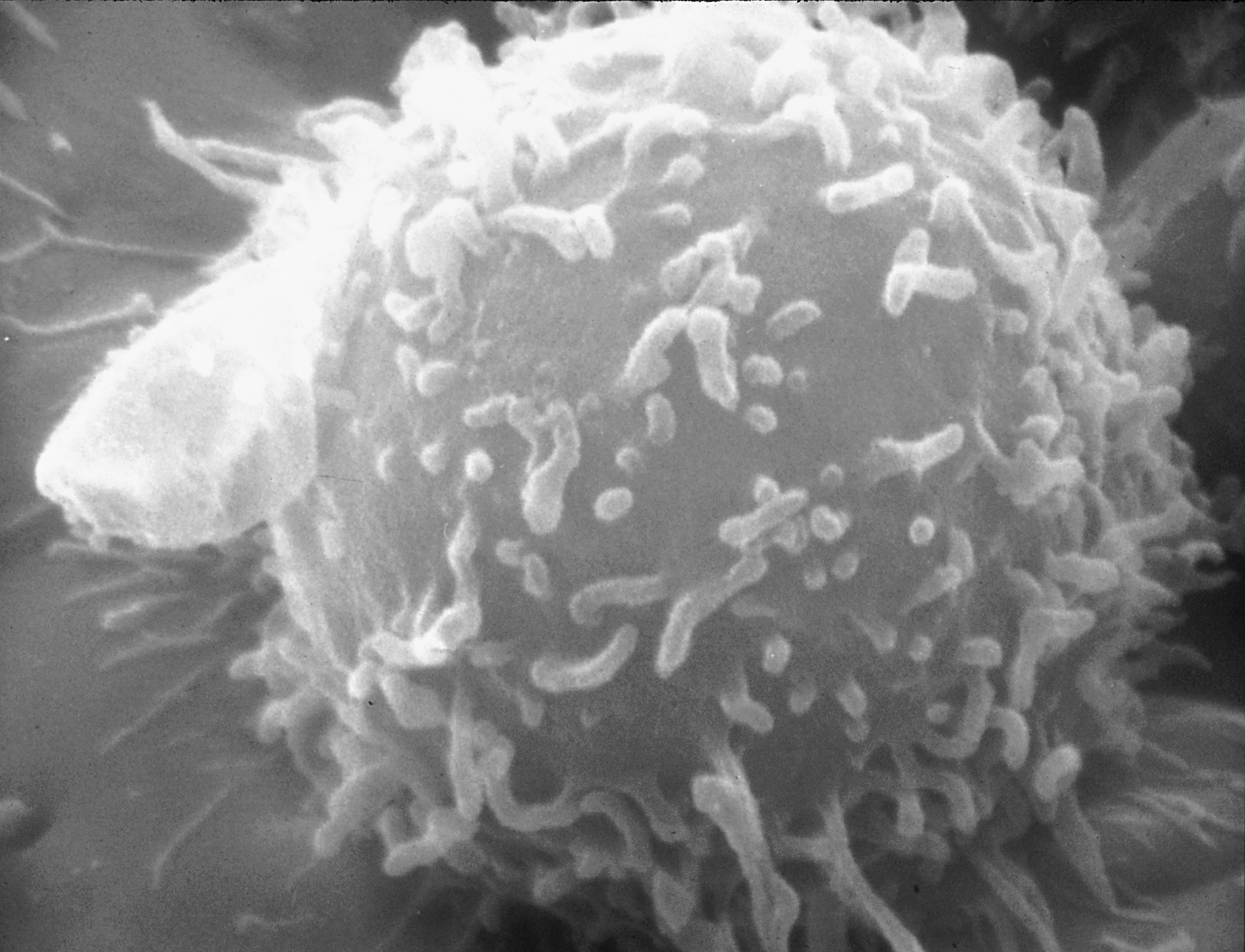 Electron micrograph of a human lymphocyte; its B-cell or T-cell identity is not established by this image.