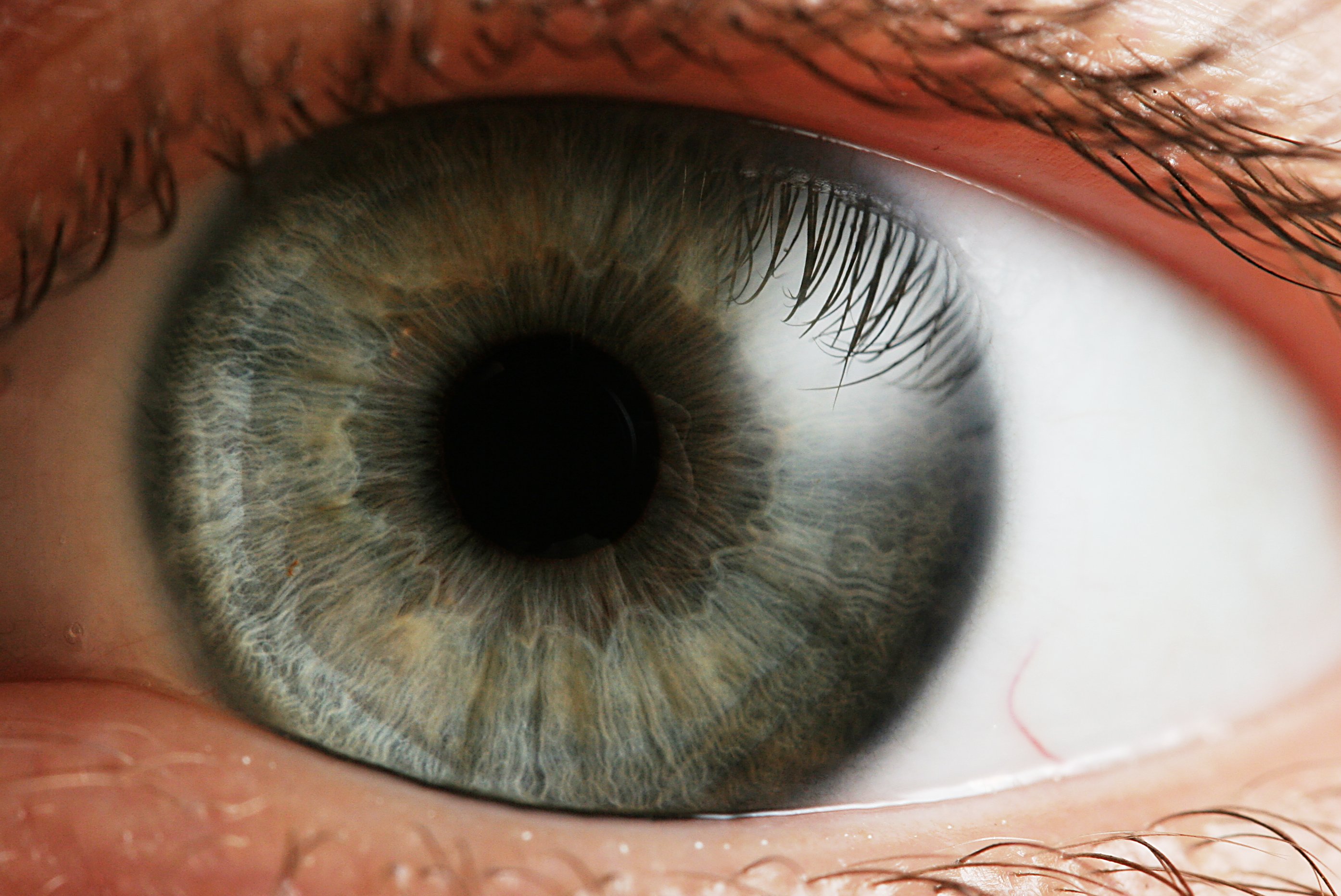 Real close-up photograph of a human eye, showing the iris, pupil, and surrounding external tissues.