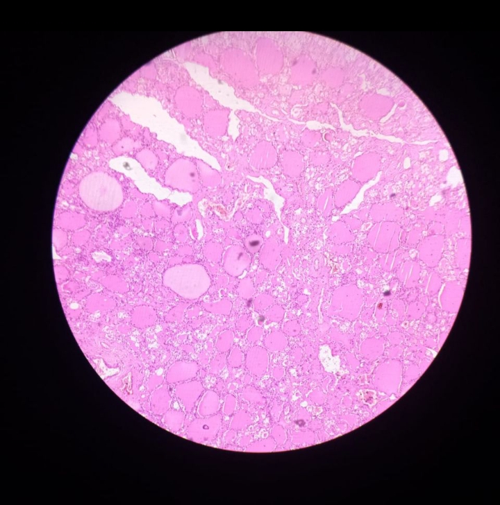 Real histological photograph of thyroid tissue stained with hematoxylin and eosin.