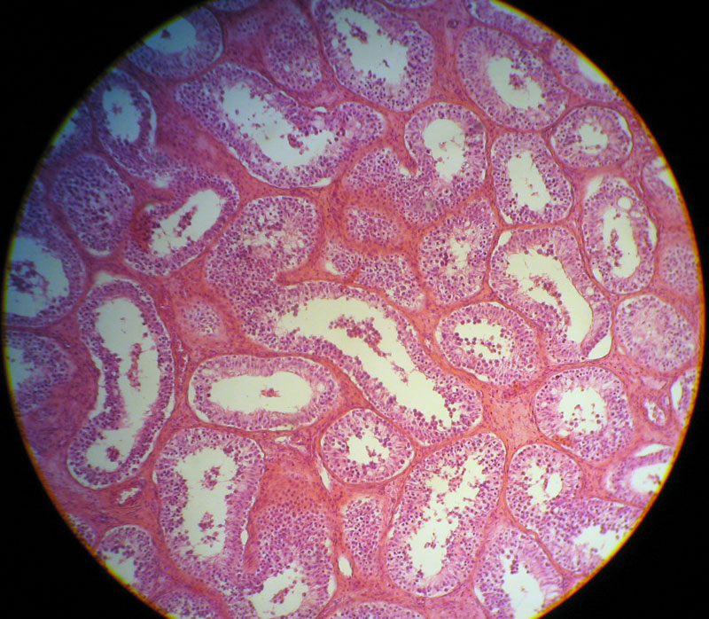 Real histological photograph of testicular tissue.